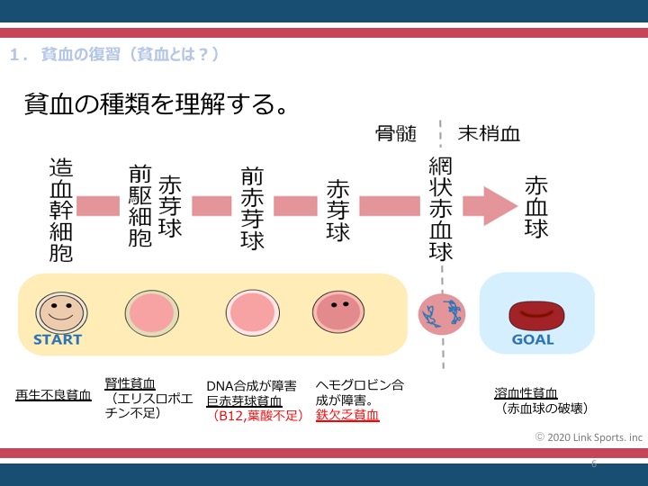 巨赤芽球性貧血の原因は何ですか?